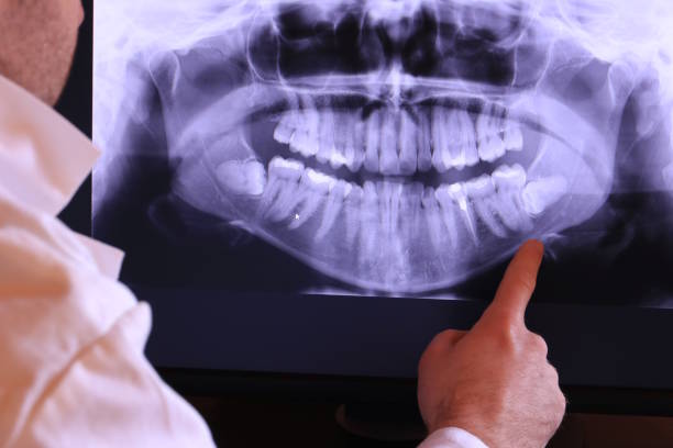 Best Same-Day Emergency Dental Services in Hopewell, VA
