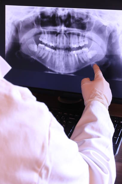 Best Emergency Tooth Extraction in Hopewell, VA