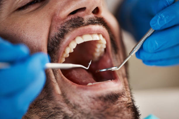 Best Cosmetic Emergency Dentistry in Hopewell, VA