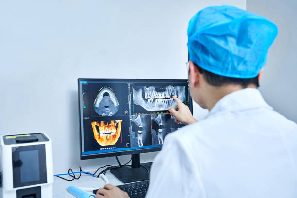 Best Emergency Wisdom Teeth Removal in Hopewell, VA
